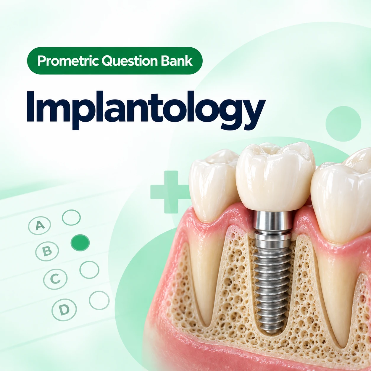 Implantology Prometric MCQ Question Bank